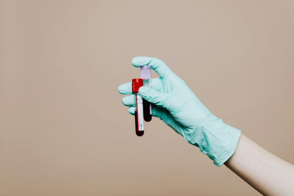 pexels-photo-4040561-4040561 Close-up of a gloved hand holding blood test tubes against neutral background.
